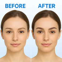 Hair Growth Roll-On Serum for Men & Women